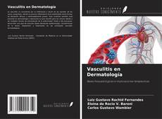 Vasculitis en Dermatología的封面