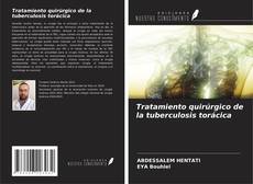 Bookcover of Tratamiento quirúrgico de la tuberculosis torácica