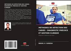 Bookcover of MÉTHODES DE DÉTECTION DES CARIES - DIAGNOSTIC PRÉCOCE ET GESTION CLINIQUE