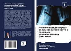 Borítókép a  Лечение псевдоартроза большеберцовой кости с помощью компрессионного фиксатора - hoz