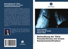 Portada del libro de Behandlung der Tibia-Pseudarthrose mit einem Kompressionsfixateur