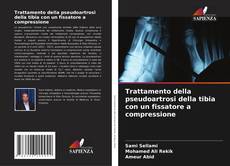 Bookcover of Trattamento della pseudoartrosi della tibia con un fissatore a compressione