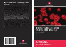 Buchcover von Biomarcadores e suas implicações clínicas