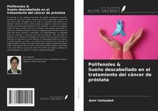 Couverture de Polifenoles & Sueño descabellado en el tratamiento del cáncer de próstata