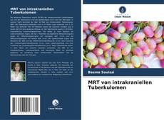 Portada del libro de MRT von intrakraniellen Tuberkulomen