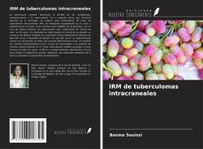 Couverture de IRM de tuberculomas intracraneales