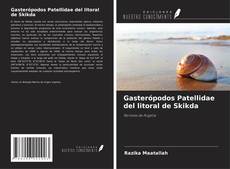 Bookcover of Gasterópodos Patellidae del litoral de Skikda