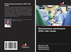 Buchcover von Dislocazione perilunare (PDL) del carpo