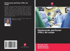 Buchcover von Deslocação perilunar (PDL) do carpo