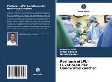 Portada del libro de Perilunäre(LPL) Luxationen der Handwurzelknochen