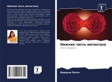 Bookcover of Нижняя часть метастаза