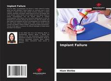 Buchcover von Implant Failure