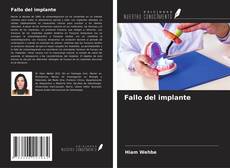 Capa do livro de Fallo del implante 