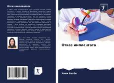 Capa do livro de Отказ имплантата 