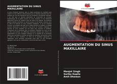 Couverture de AUGMENTATION DU SINUS MAXILLAIRE