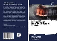 Bookcover of АУГМЕНТАЦИЯ ВЕРХНЕЧЕЛЮСТНОЙ ПАЗУХИ