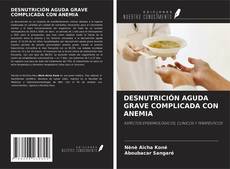 Bookcover of DESNUTRICIÓN AGUDA GRAVE COMPLICADA CON ANEMIA