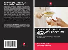 Bookcover of DESNUTRIÇÃO AGUDA GRAVE COMPLICADA POR ANEMIA