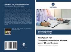 Häufigkeit von Thrombozytopenie bei Kindern unter Chemotherapie kitap kapağı