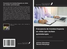 Bookcover of Frecuencia de trombocitopenia en niños que reciben quimioterapia