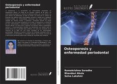 Buchcover von Osteoporosis y enfermedad periodontal