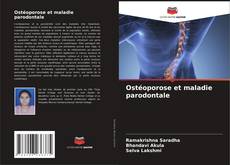Capa do livro de Ostéoporose et maladie parodontale 