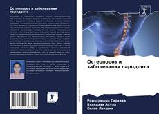 Bookcover of Остеопороз и заболевания пародонта