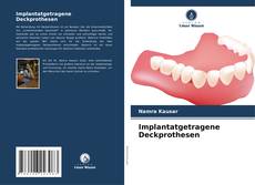 Implantatgetragene Deckprothesen kitap kapağı