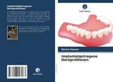 Portada del libro de Implantatgetragene Deckprothesen