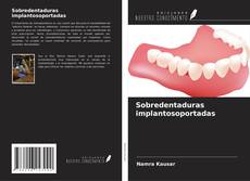 Sobredentaduras implantosoportadas kitap kapağı