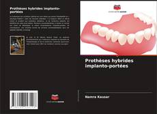 Prothèses hybrides implanto-portées kitap kapağı