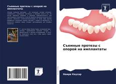 Bookcover of Съемные протезы с опорой на имплантаты