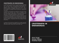 Bookcover of CRIOTERAPIA IN ENDODONZIA