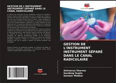 Couverture de GESTION DE L'INSTRUMENT INSTRUMENT SÉPARÉ DANS LE CANAL RADICULAIRE