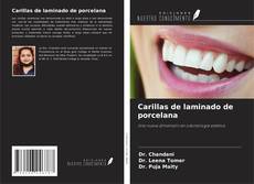 Bookcover of Carillas de laminado de porcelana