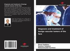 Buchcover von Diagnosis and treatment of benign vascular tumors of the face
