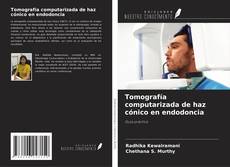 Tomografía computarizada de haz cónico en endodoncia的封面