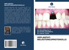 Buchcover von IMPLANTAT-BELASTUNGSPROTOKOLLE