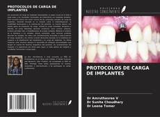 PROTOCOLOS DE CARGA DE IMPLANTES kitap kapağı