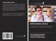 Bookcover of Enfermedad celíaca