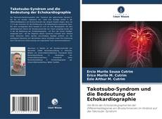 Takotsubo-Syndrom und die Bedeutung der Echokardiographie kitap kapağı