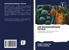 Buchcover von АНГИОМИОЛИПОМА ПОЧКИ