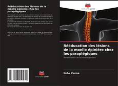 Buchcover von Rééducation des lésions de la moelle épinière chez les paraplégiques