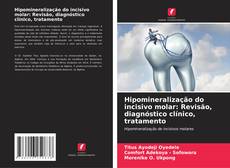 Buchcover von Hipomineralização do incisivo molar: Revisão, diagnóstico clínico, tratamento