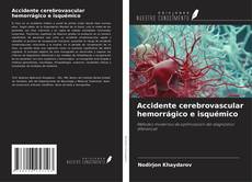 Bookcover of Accidente cerebrovascular hemorrágico e isquémico