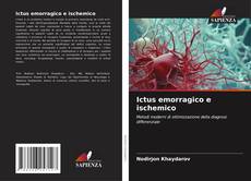 Ictus emorragico e ischemico的封面