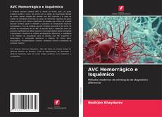 AVC Hemorrágico e Isquêmico kitap kapağı