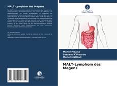 MALT-Lymphom des Magens kitap kapağı