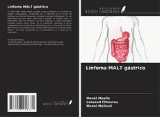 Linfoma MALT gástrico kitap kapağı