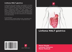 Bookcover of Linfoma MALT gástrico